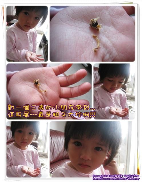 [禾日記] 好大的耳屎唷!!!