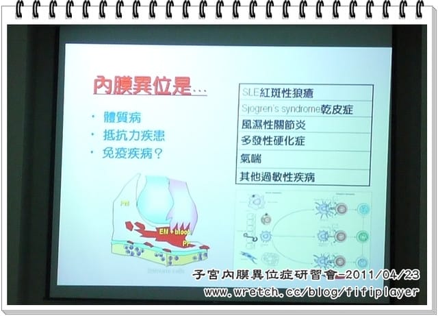 四月雜記．哩哩叩叩…