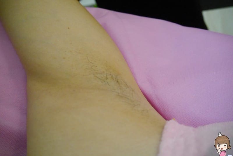 嘉義太保蜜蠟除毛初體驗｜腋毛、手毛腳毛、多處除毛