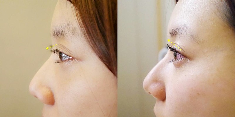 台南安平區‧角蛋白美睫 美麗莊園 lady spa