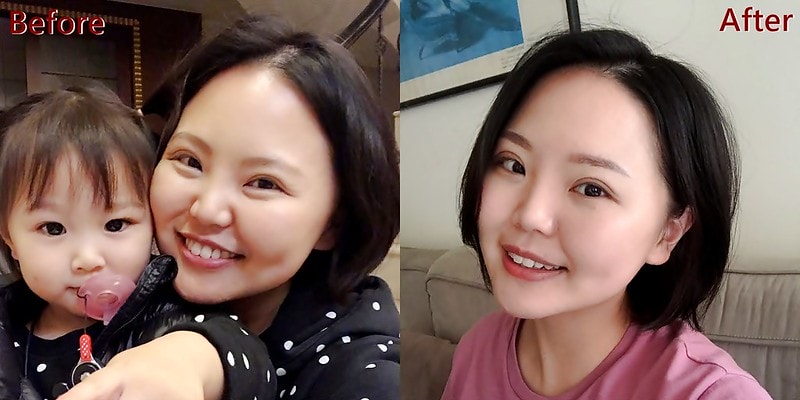 霧眉前後(台中黛玲老師)