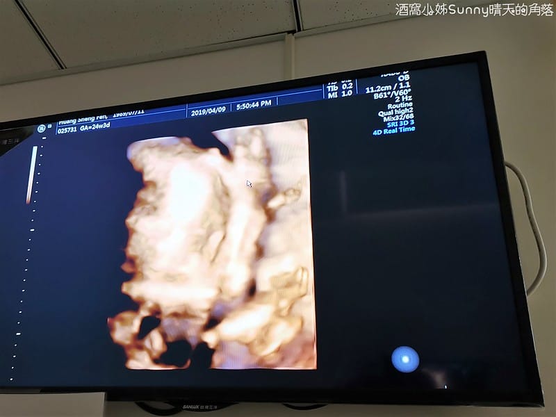 嘉義產檢x嘉安婦幼診所x4D高層次超音波檢查