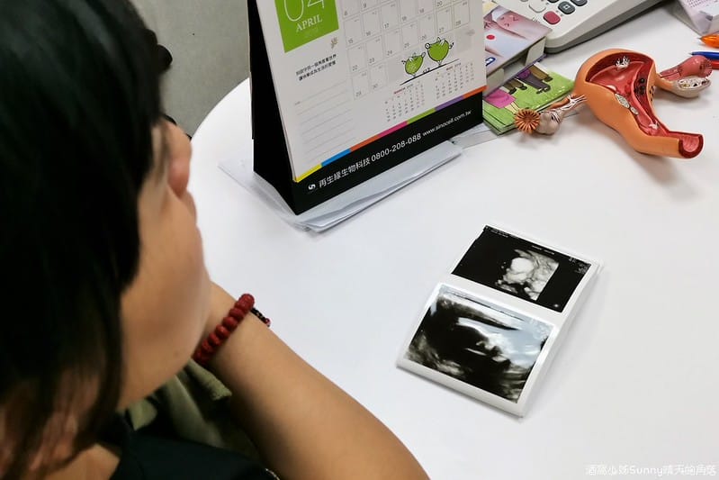 嘉義產檢x嘉安婦幼診所x4D高層次超音波檢查